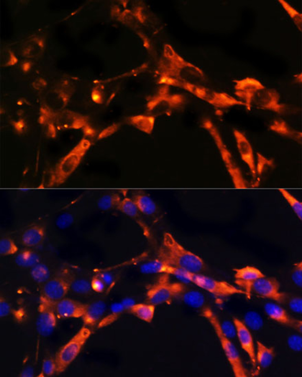 Immunofluorescence analysis of NIH/3T3 cells using DPP4 Polyclonal Antibody at dilution of  1:100. Blue: DAPI for nuclear staining.