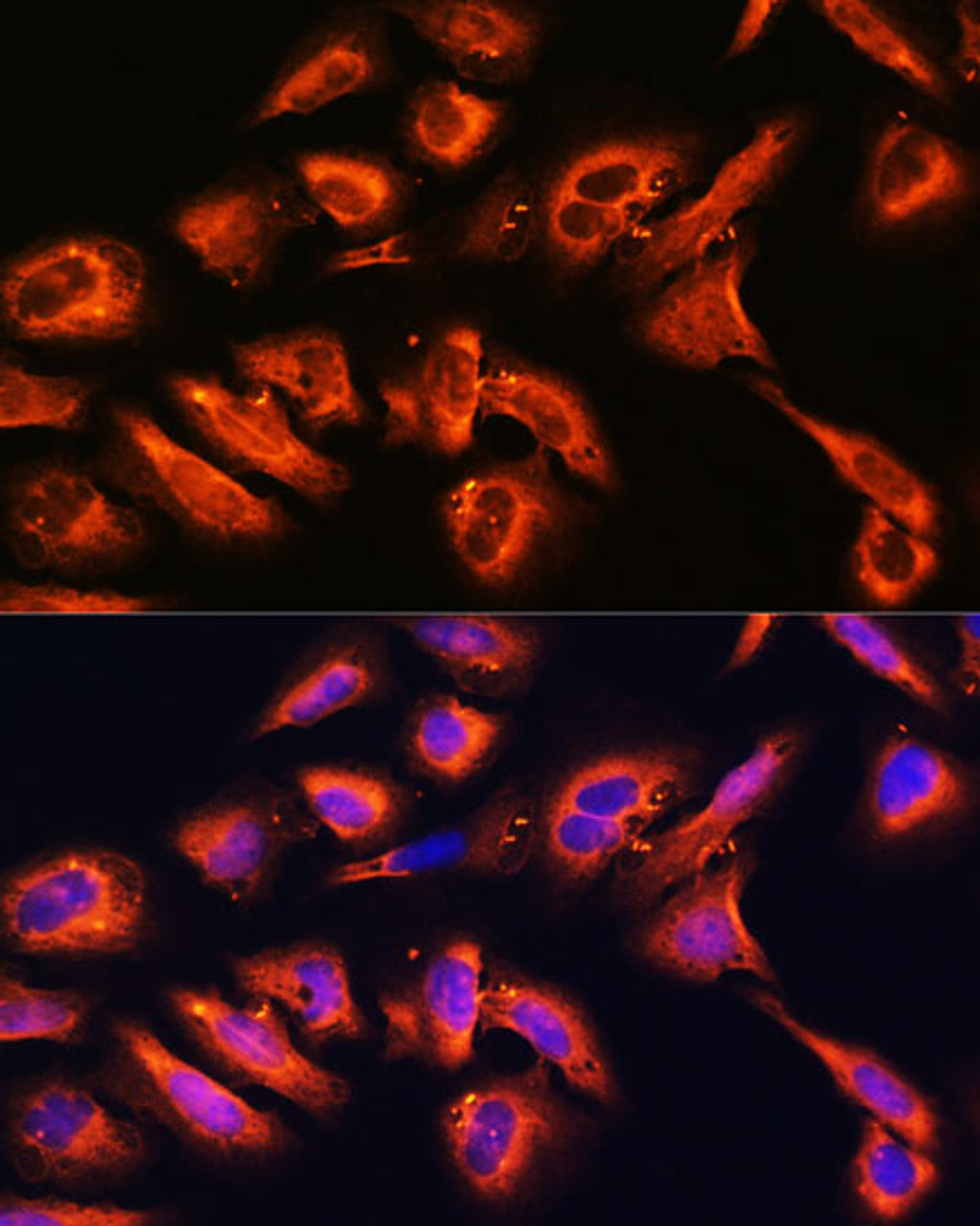 Immunofluorescence analysis of U2OS cells using DPP4 Polyclonal Antibody at dilution of  1:100. Blue: DAPI for nuclear staining.