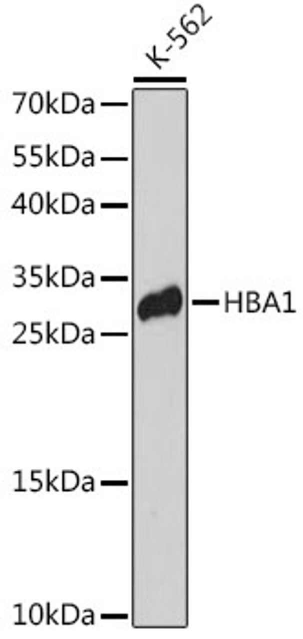 Western blot analysis of extracts of K-562 cells using HBA1 Polyclonal Antibody at dilution of 1:3000.