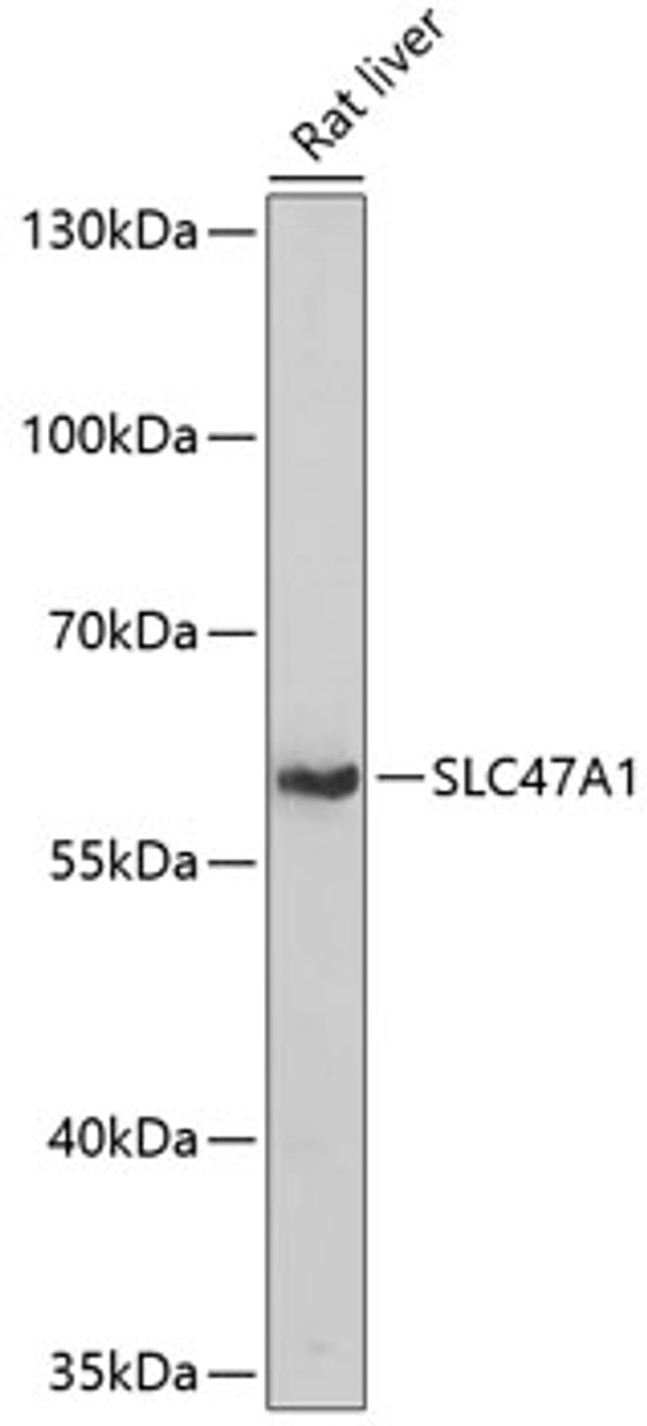 Western blot analysis of extracts of Rat liver using SLC47A1 Polyclonal Antibody at dilution of 1:1000.
