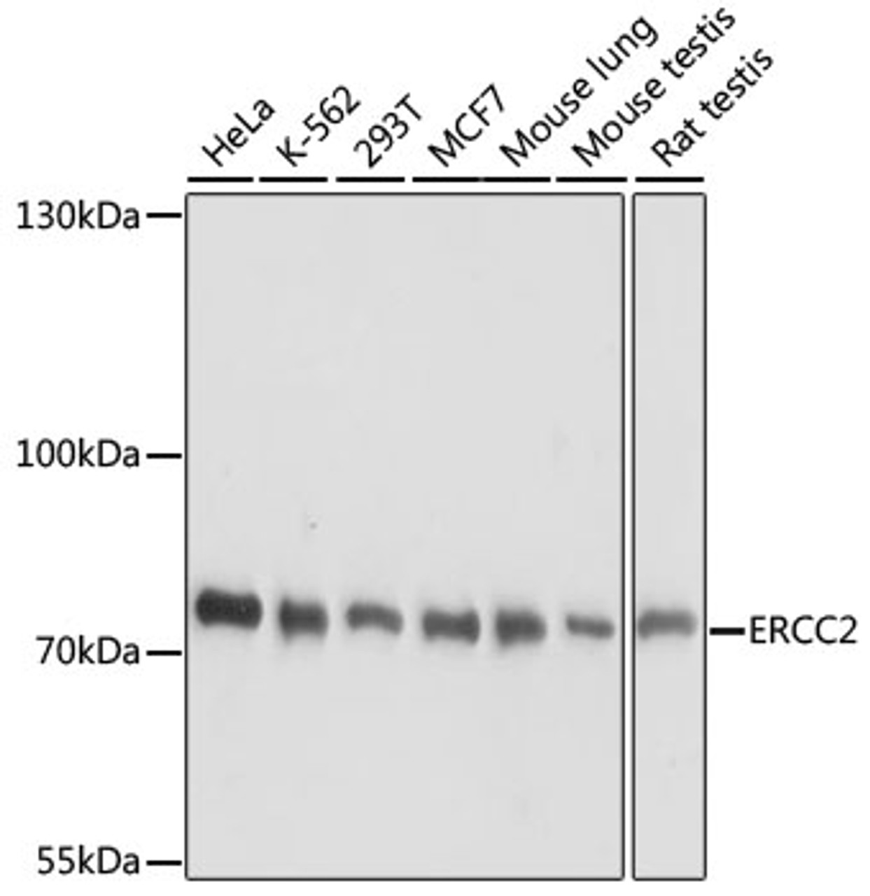 Western blot analysis of extracts of various cell lines using ERCC2 Polyclonal Antibody at dilution of 1:1000.