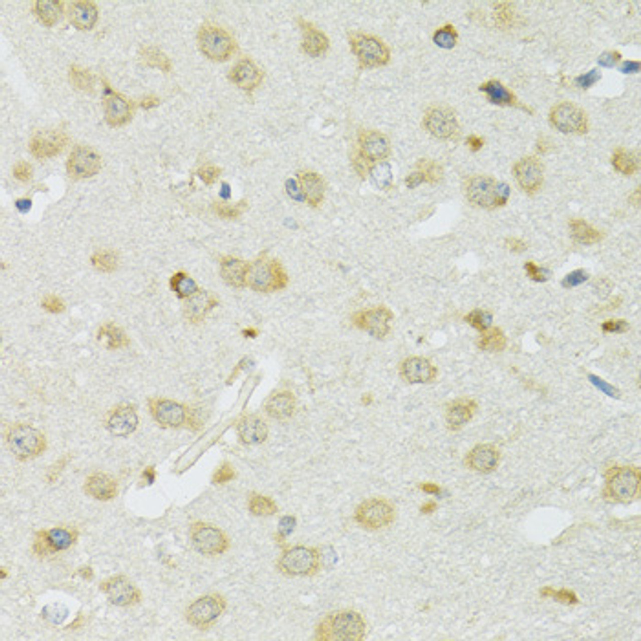 Immunohistochemistry of paraffin-embedded Mouse brain using SLC37A4 Polyclonal Antibody at dilution of  1:100 (40x lens).