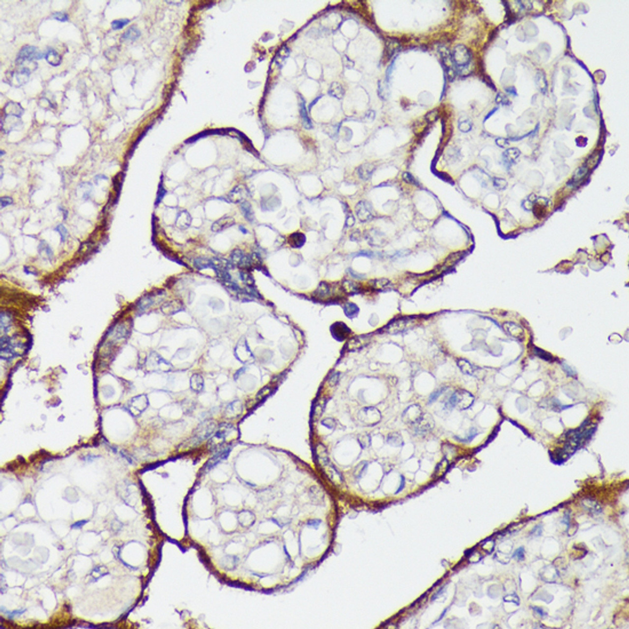 Immunohistochemistry of paraffin-embedded Human placenta using SLC7A2 Polyclonal Antibody at dilution of  1:100 (40x lens).