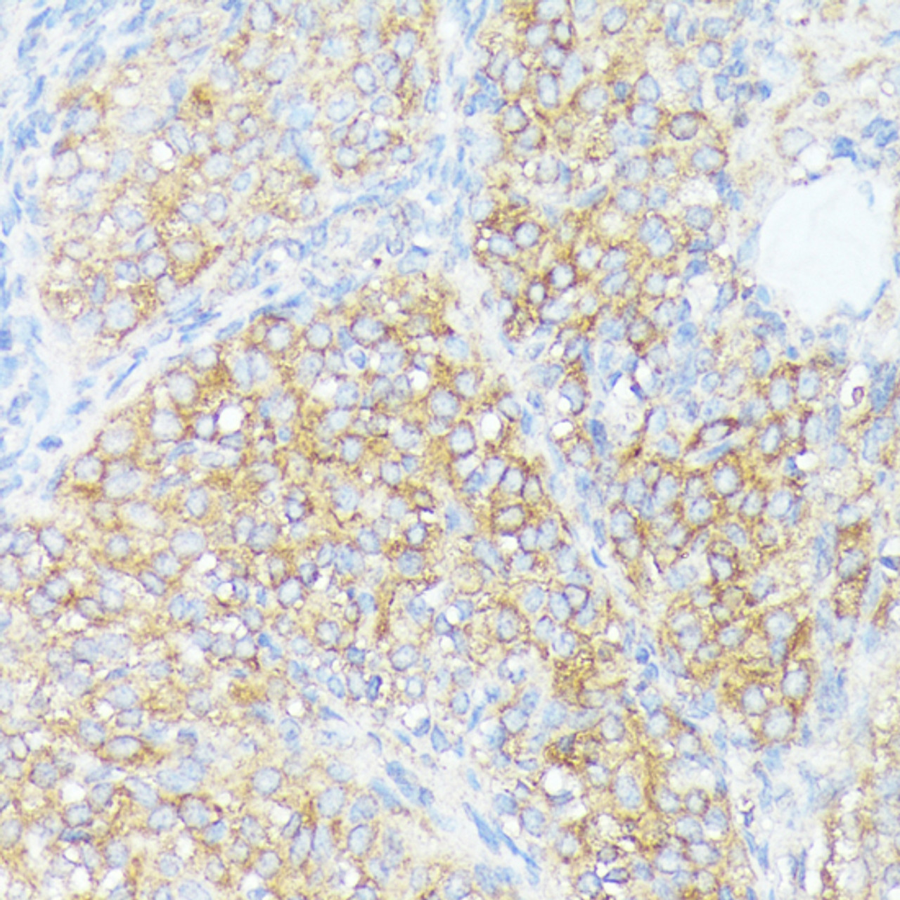 Immunohistochemistry of paraffin-embedded Rat ovary using SLC7A2 Polyclonal Antibody at dilution of  1:100 (40x lens).