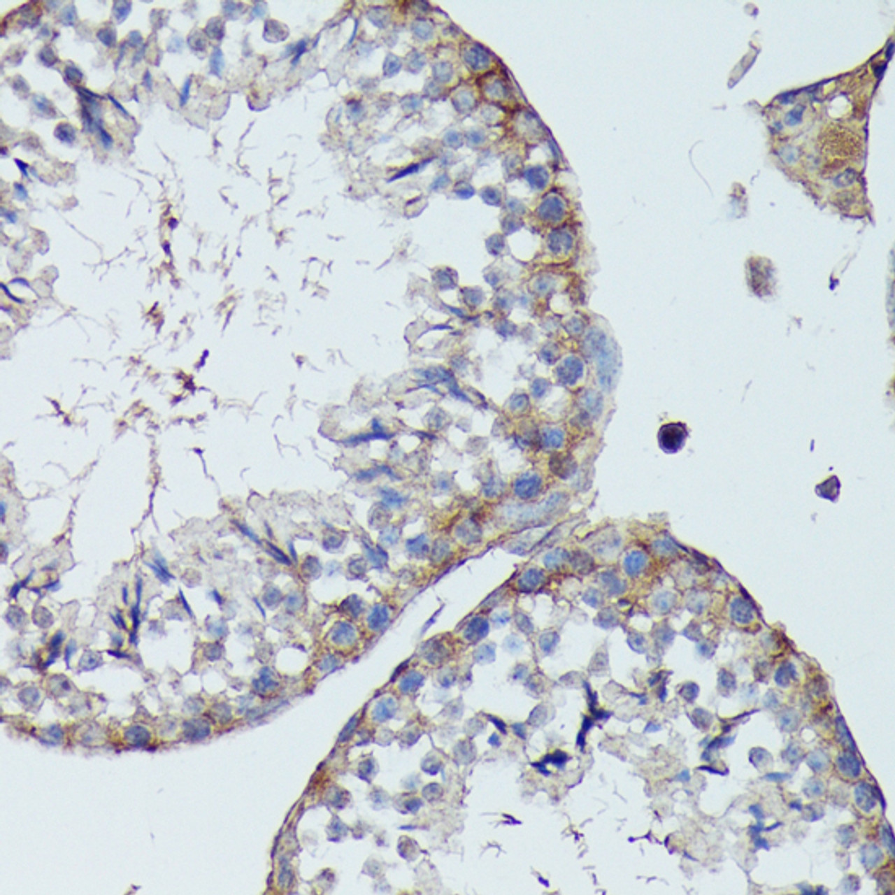 Immunohistochemistry of paraffin-embedded Mouse testis using SLC7A2 Polyclonal Antibody at dilution of  1:100 (40x lens).