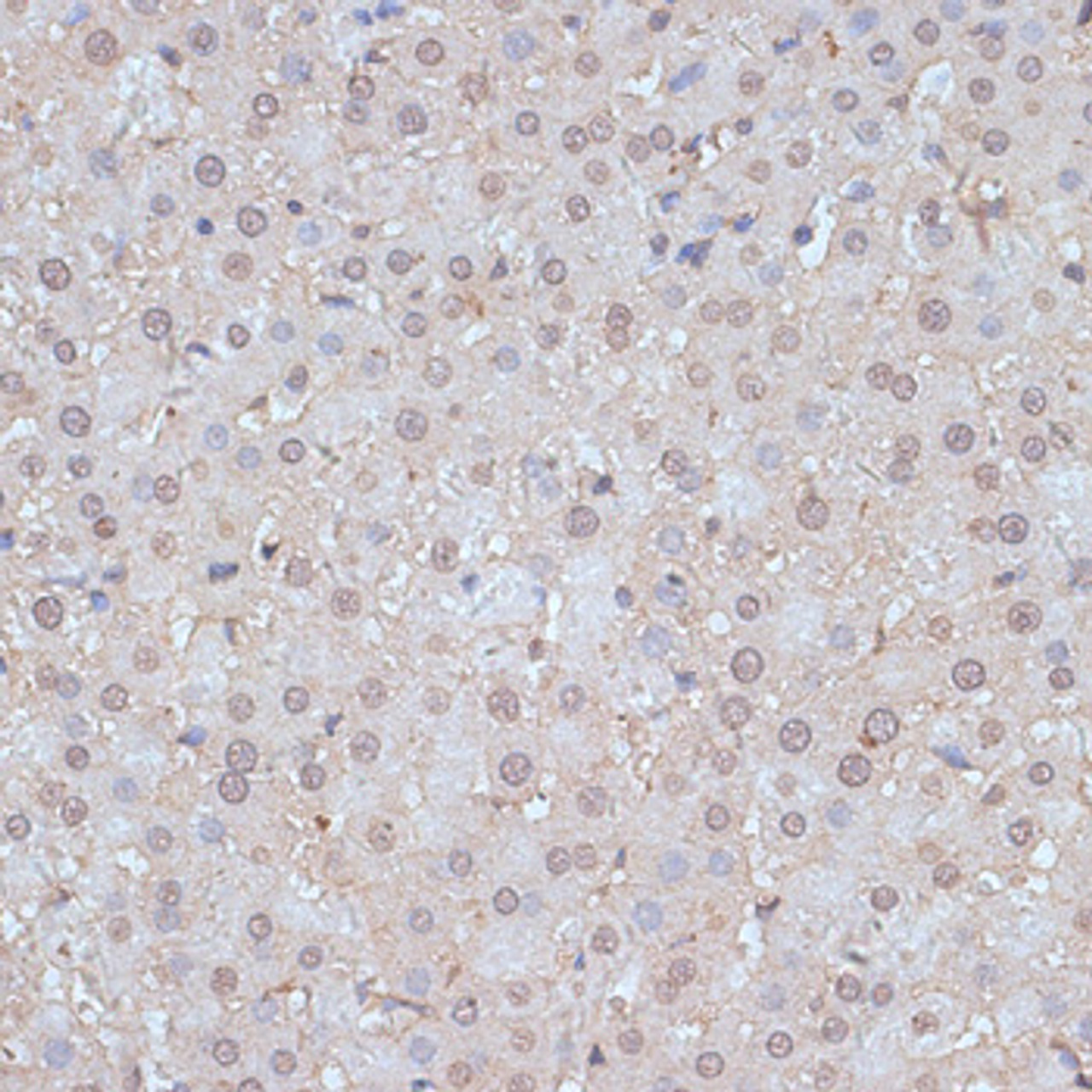 Immunohistochemistry of paraffin-embedded Rat liver using SNW1 Polyclonal Antibody at dilution of  1:100 (40x lens).