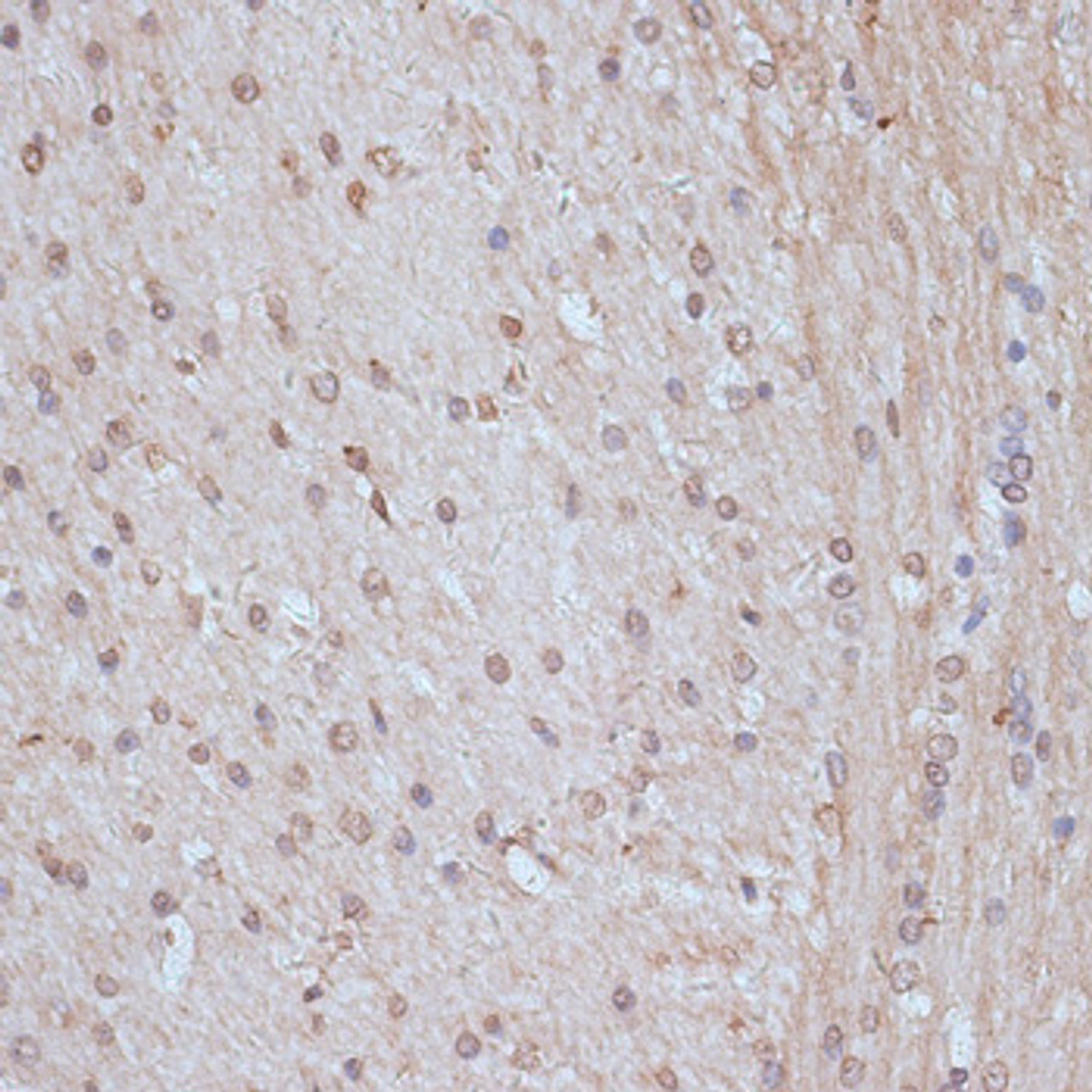 Immunohistochemistry of paraffin-embedded Rat brain using SNW1 Polyclonal Antibody at dilution of  1:100 (40x lens).