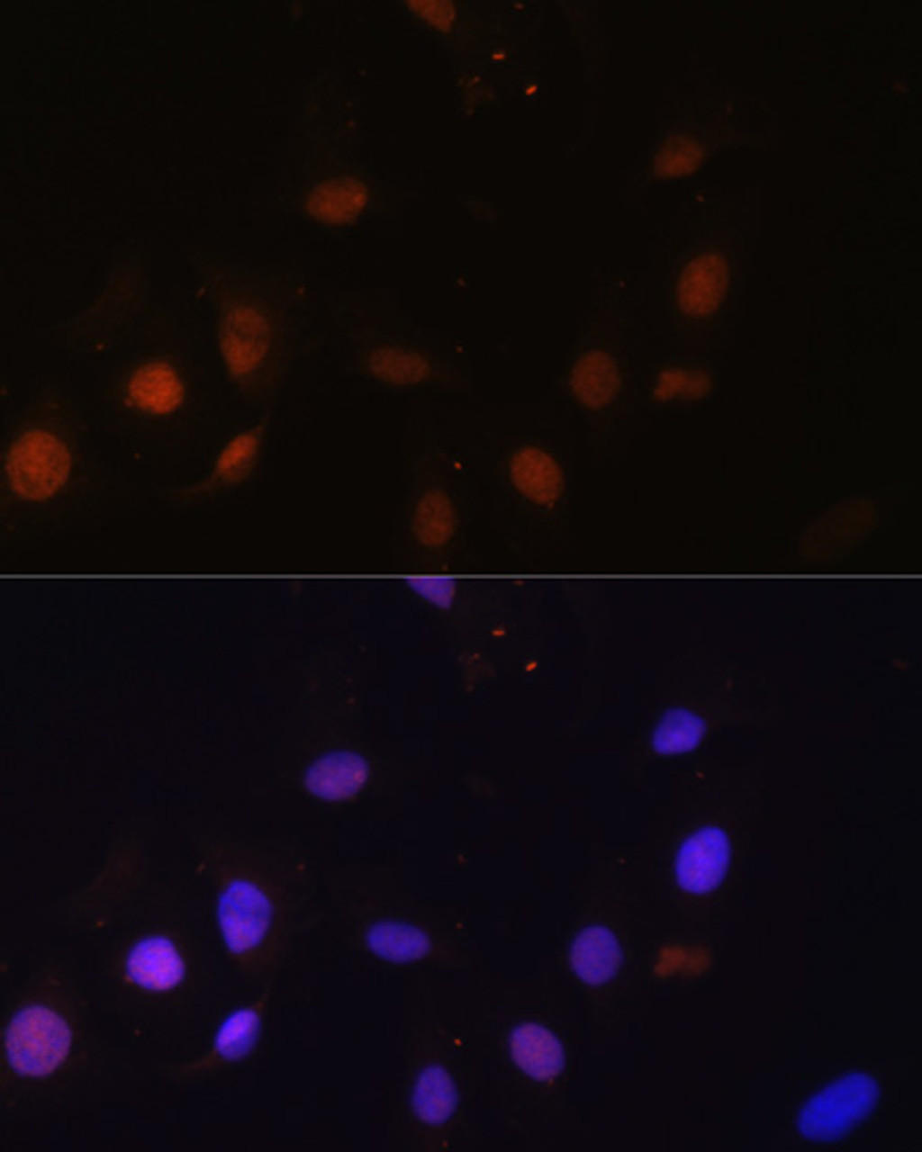 Immunofluorescence analysis of U-2 OS cells using SNW1 Polyclonal Antibody at dilution of  1:100. Blue: DAPI for nuclear staining.