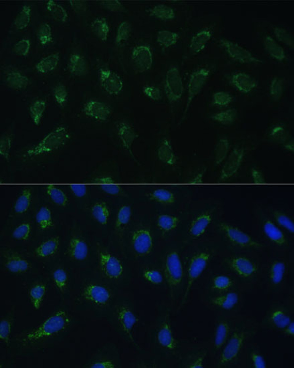 Immunofluorescence analysis of U-2 OS cells using HIGD1A Polyclonal Antibody at dilution of  1:100 (40x lens). Blue: DAPI for nuclear staining.