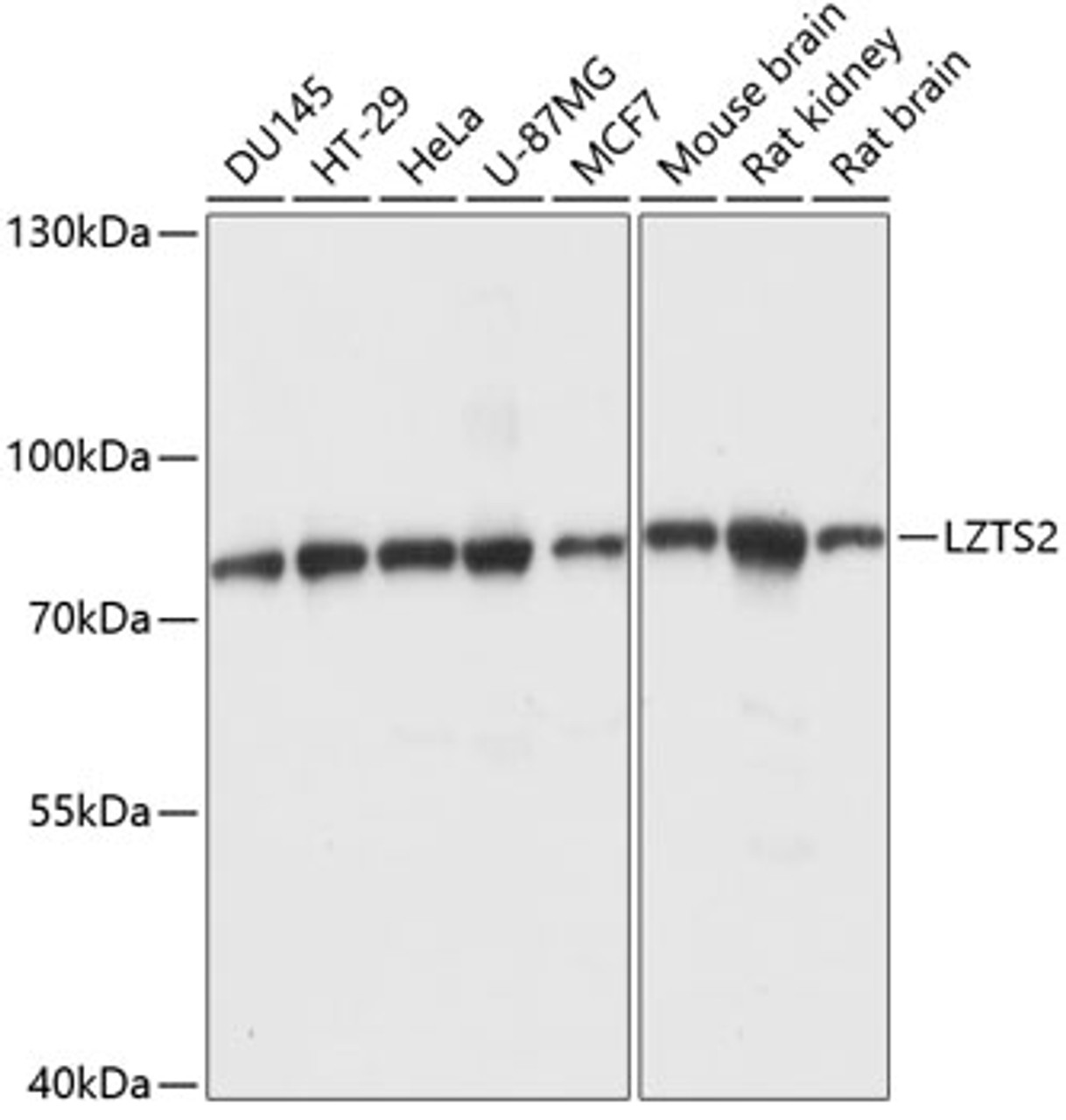 Western blot analysis of extracts of various cell lines using LZTS2 Polyclonal Antibody at dilution of 1:1000.
