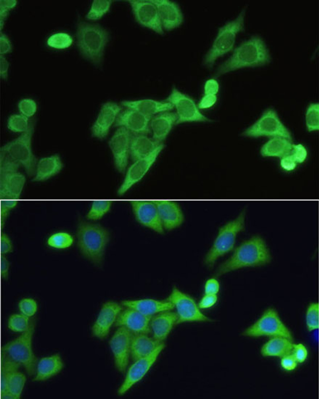 Immunofluorescence analysis of HeLa cells using SLC2A9 Polyclonal Antibody at dilution of  1:100. Blue: DAPI for nuclear staining.