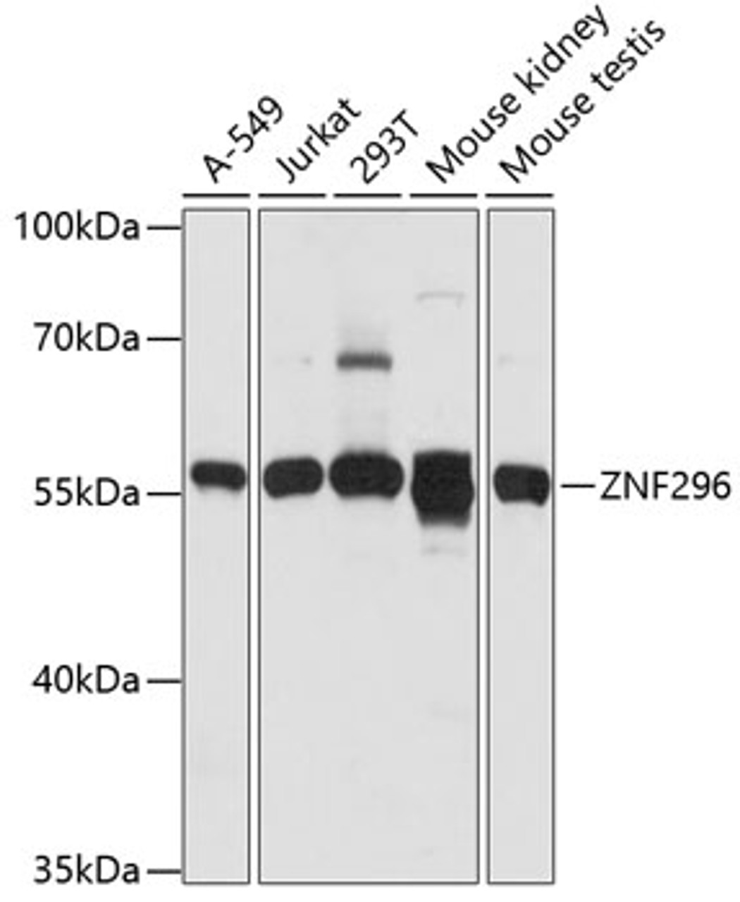 Western blot analysis of extracts of various cell lines using ZNF296 Polyclonal Antibody at dilution of 1:1000.