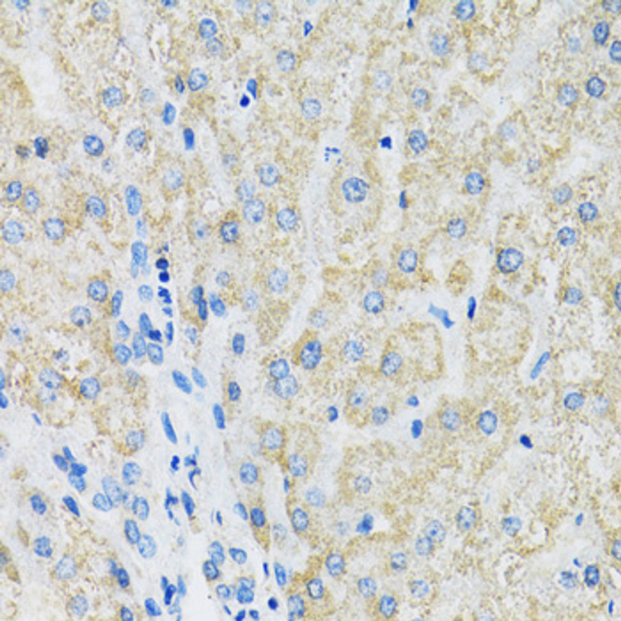 Immunohistochemistry of paraffin-embedded Human liver using SLC19A1 Polyclonal Antibody at dilution of  1:100 (40x lens).