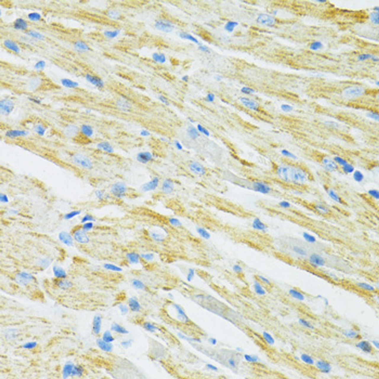 Immunohistochemistry of paraffin-embedded Mouse heart using SLC19A1 Polyclonal Antibody at dilution of  1:100 (40x lens).