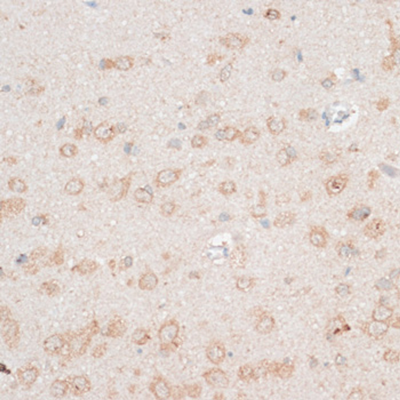 Immunohistochemistry of paraffin-embedded Rat brain using CDH18 Polyclonal Antibody at dilution of  1:100 (40x lens).