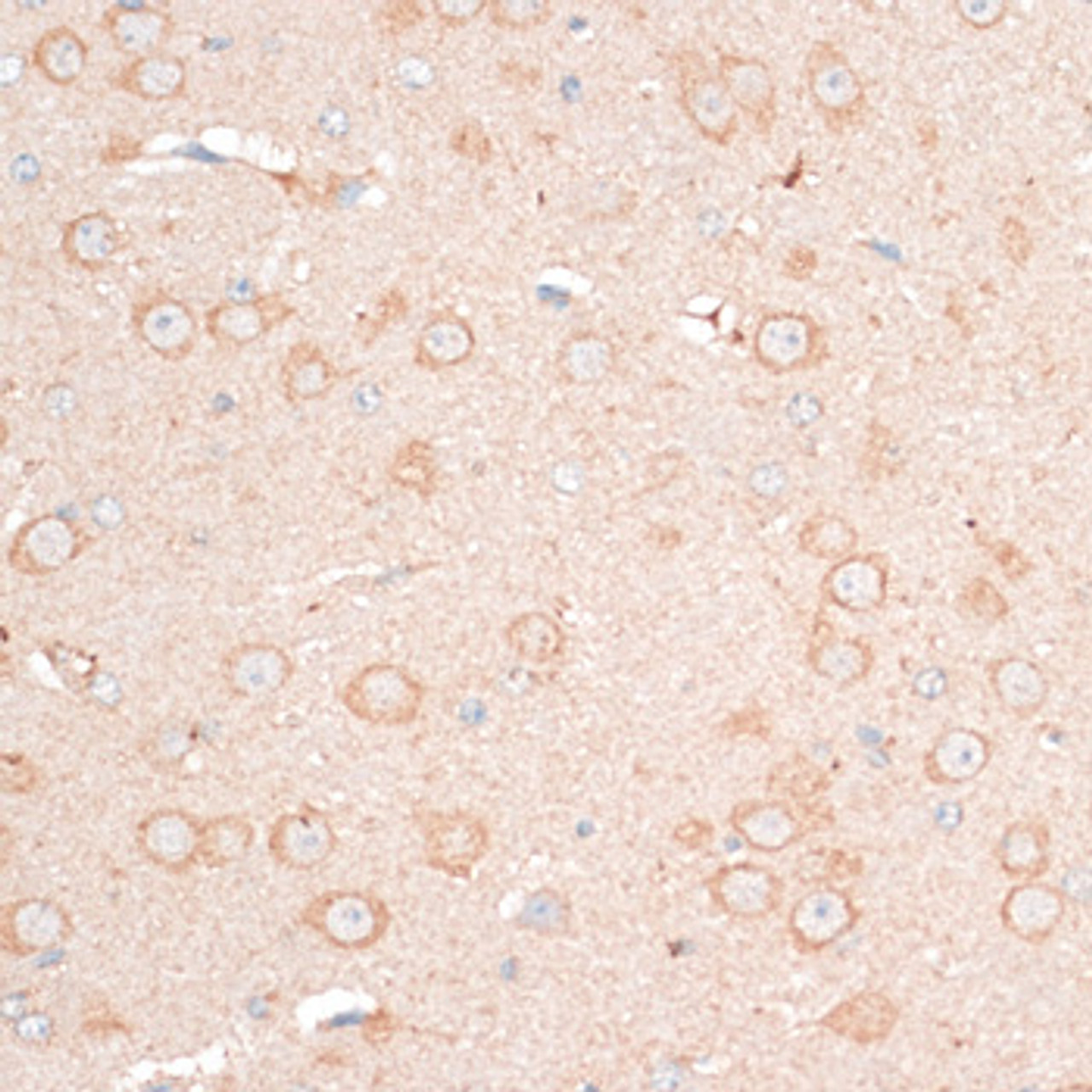 Immunohistochemistry of paraffin-embedded Mouse brain using CDH18 Polyclonal Antibody at dilution of  1:100 (40x lens).