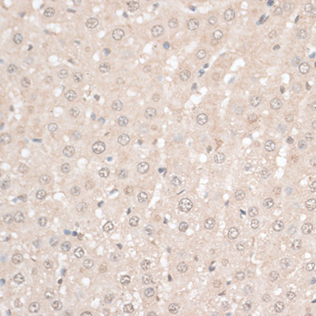 Immunohistochemistry of paraffin-embedded Rat liver using HMGN1 Polyclonal Antibody at dilution of  1:100 (40x lens).