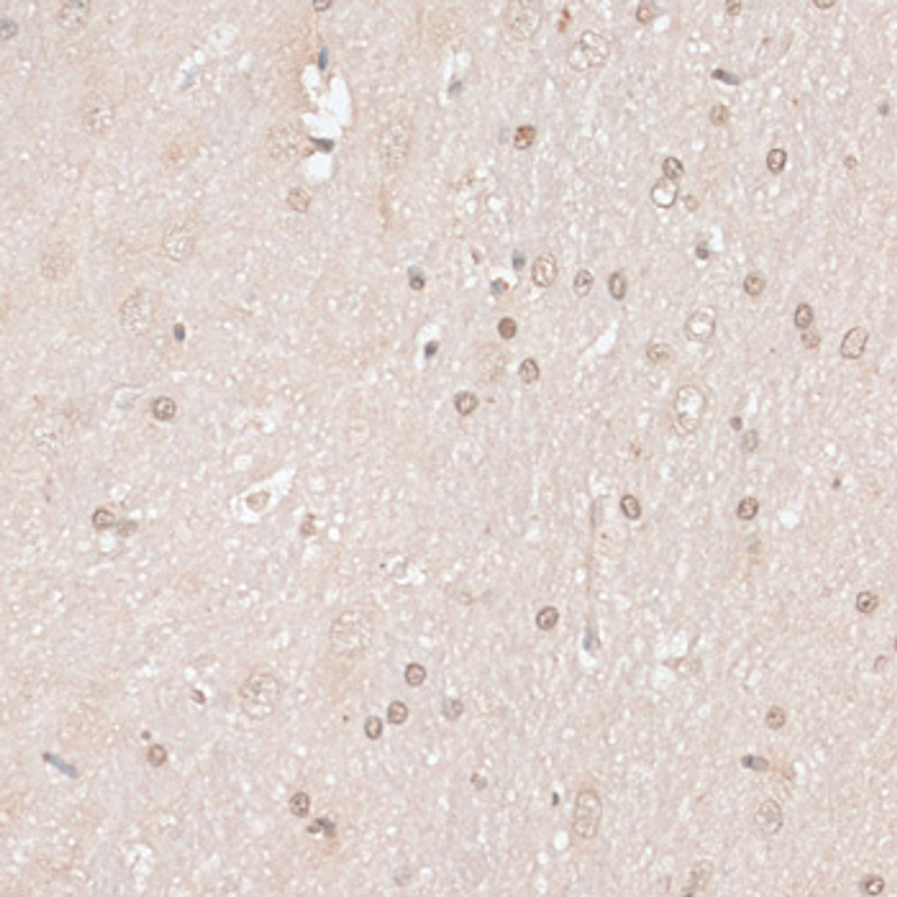 Immunohistochemistry of paraffin-embedded Rat brain using HMGN1 Polyclonal Antibody at dilution of  1:100 (40x lens).