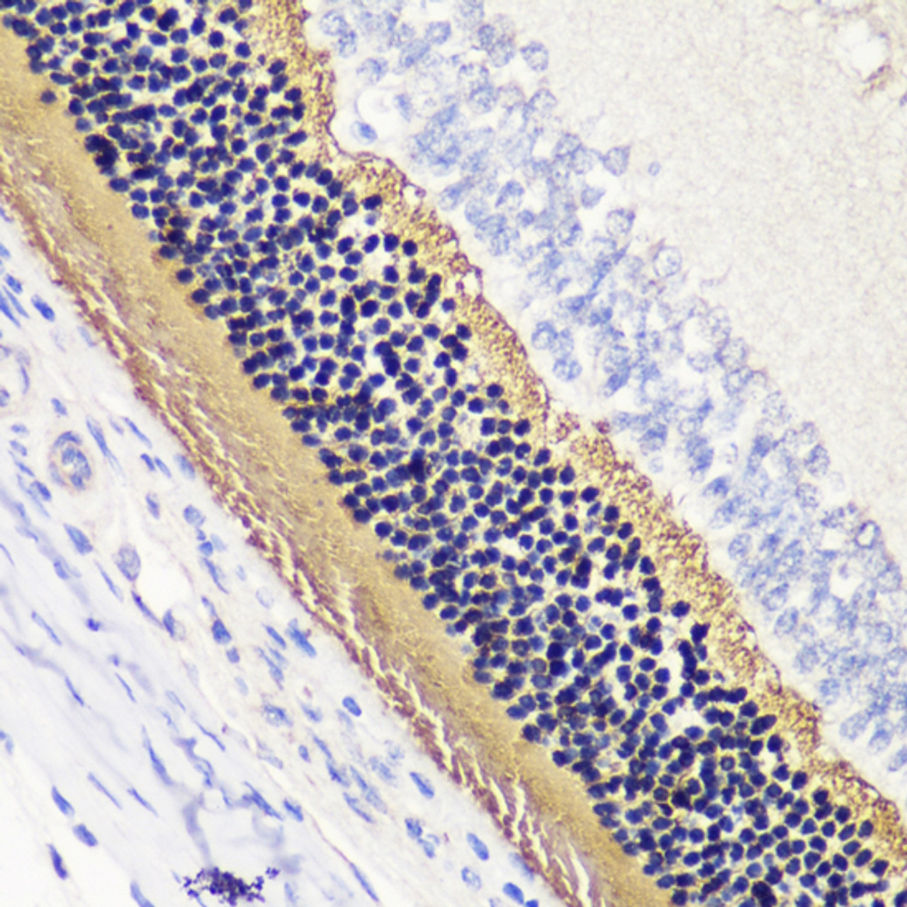 Immunohistochemistry of paraffin-embedded Rat retina using PDC Polyclonal Antibody at dilution of  1:200 (40x lens).