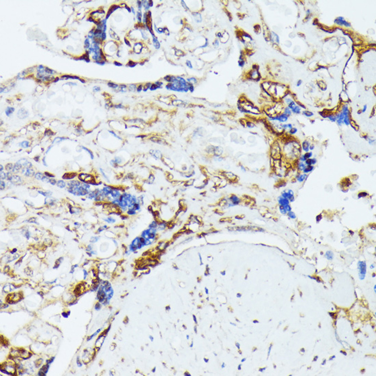Immunohistochemistry of paraffin-embedded Human placenta using COX15 Polyclonal Antibody at dilution of  1:100 (40x lens).