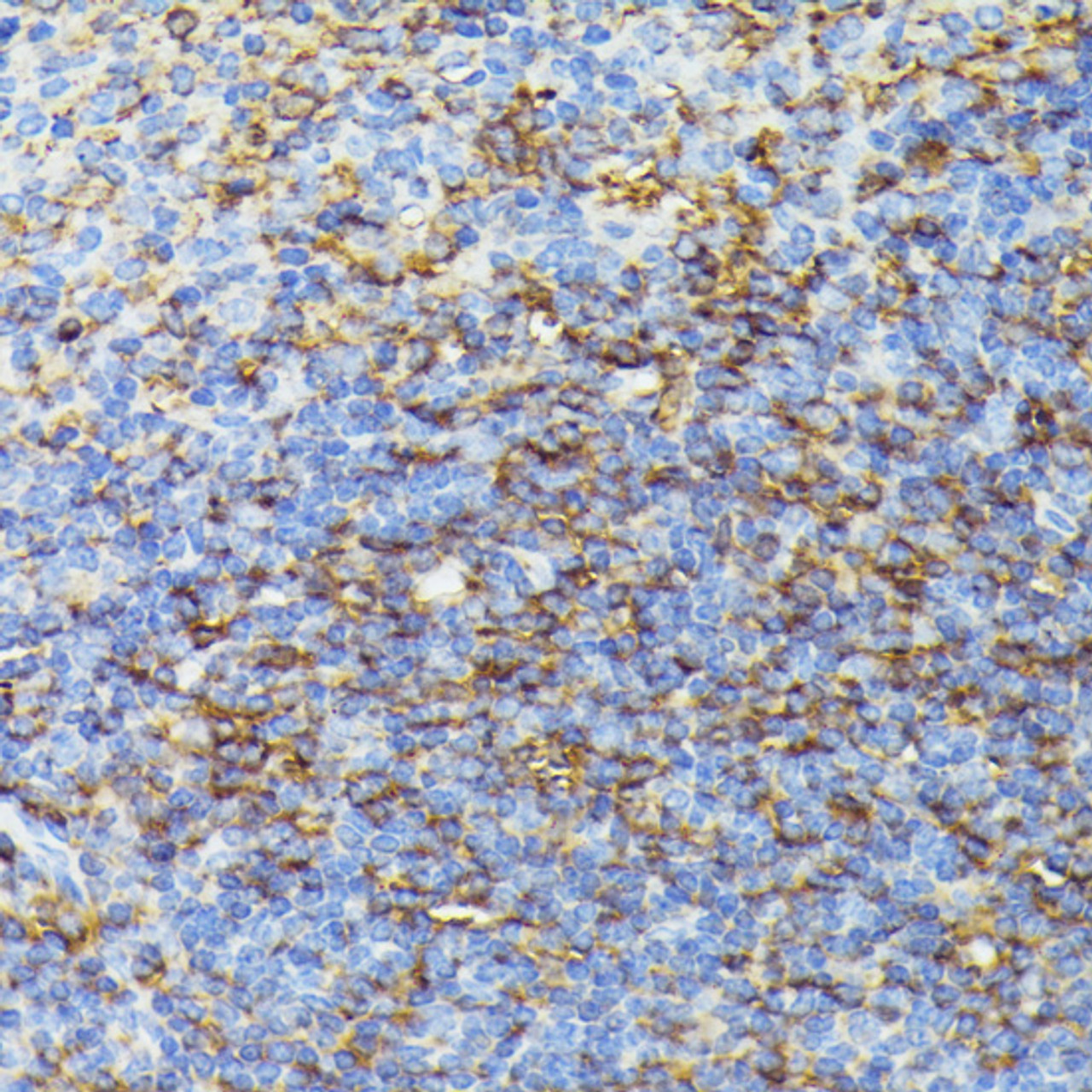 Immunohistochemistry of paraffin-embedded Mouse spleen using COX15 Polyclonal Antibody at dilution of  1:100 (40x lens).