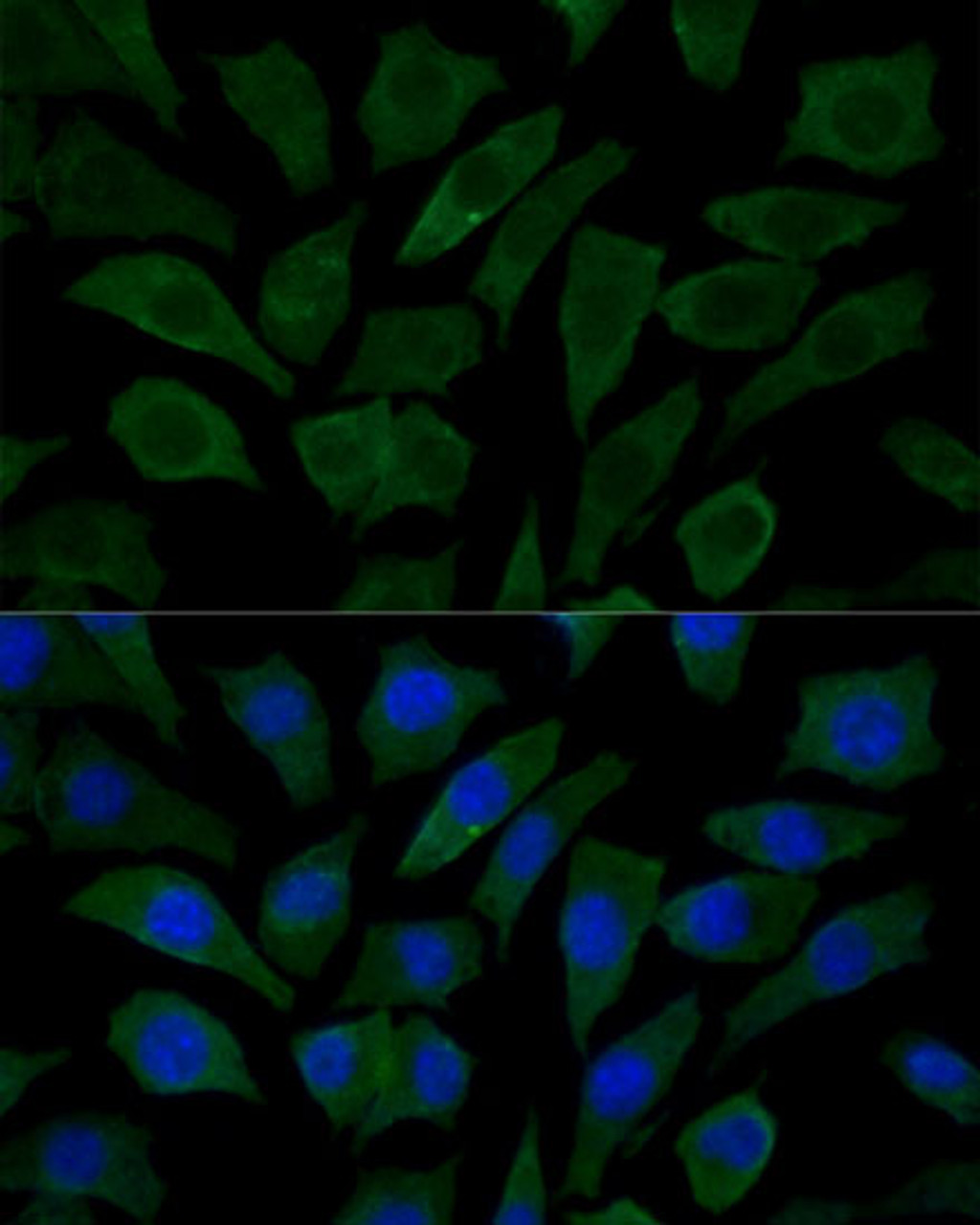 Immunofluorescence analysis of L929 cells using COX15 Polyclonal Antibody at dilution of  1:100 (40x lens). Blue: DAPI for nuclear staining.