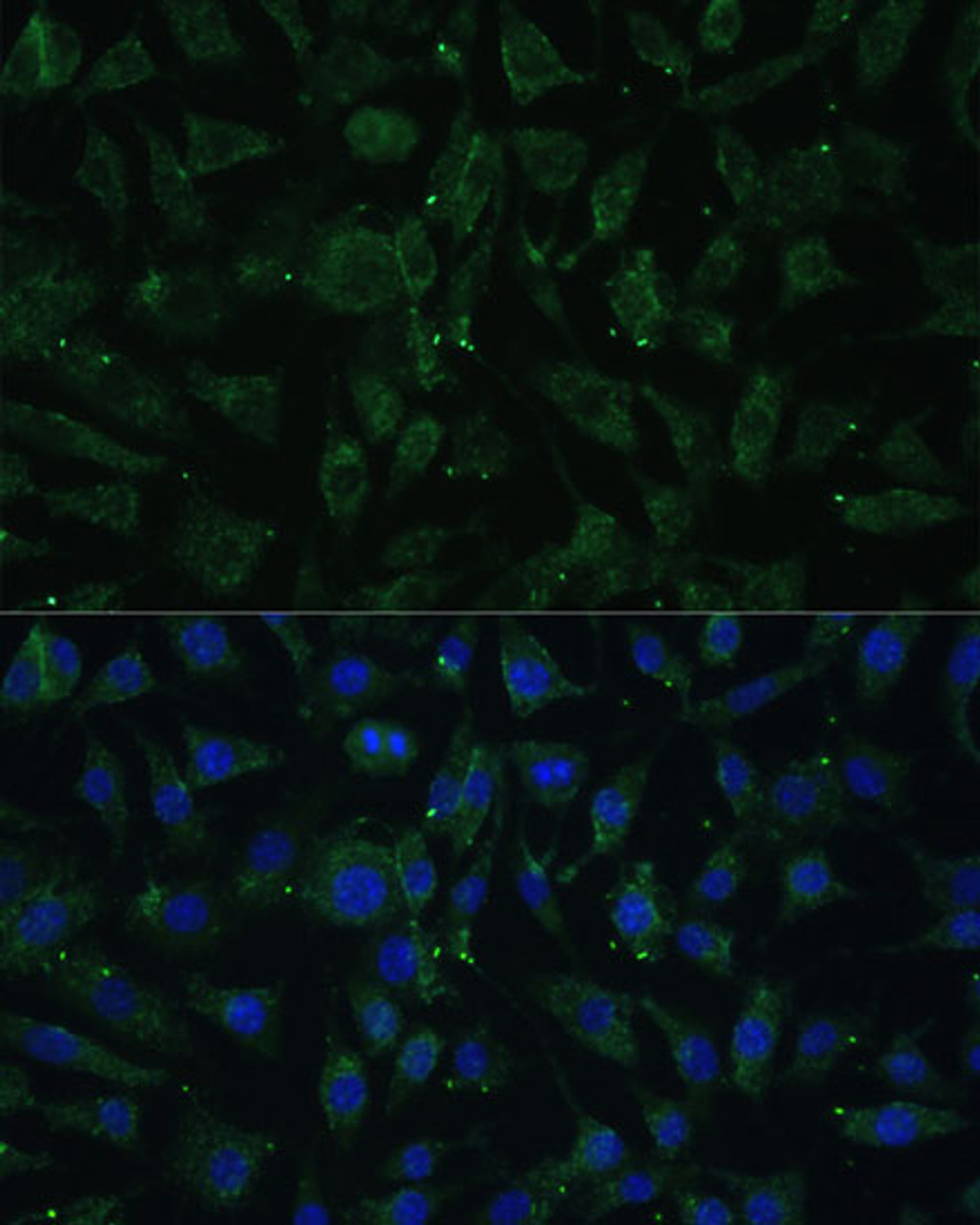 Immunofluorescence analysis of L929 cells using APH1A Polyclonal Antibody at dilution of  1:100 (40x lens). Blue: DAPI for nuclear staining.