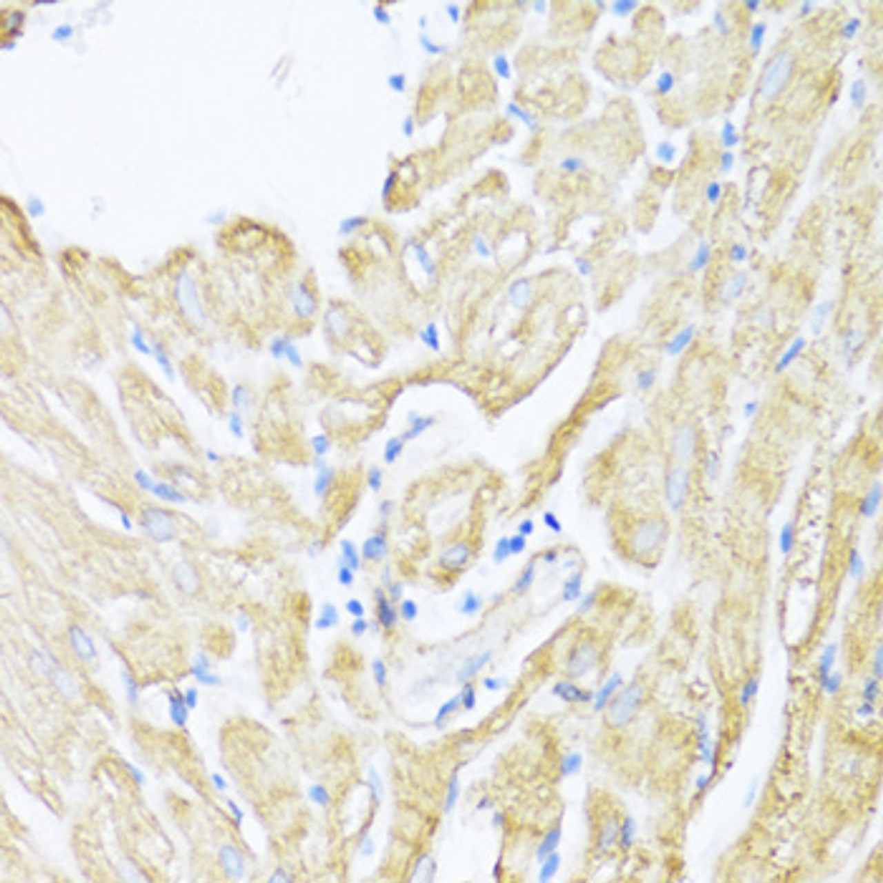 Immunohistochemistry of paraffin-embedded Rat heart using ALOX12 Polyclonal Antibody at dilution of  1:100 (40x lens).