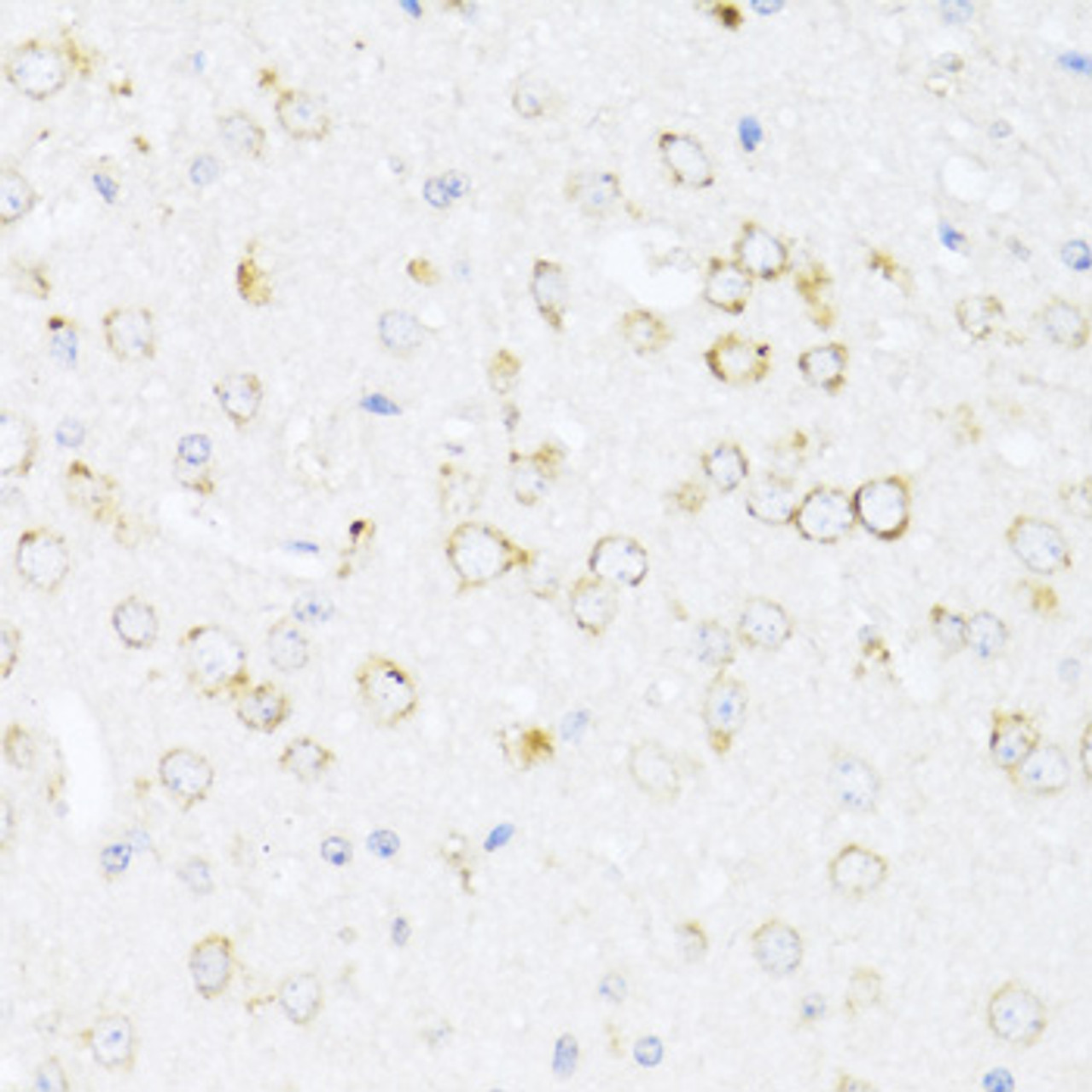 Immunohistochemistry of paraffin-embedded Mouse brain using ALOX12 Polyclonal Antibody at dilution of  1:100 (40x lens).