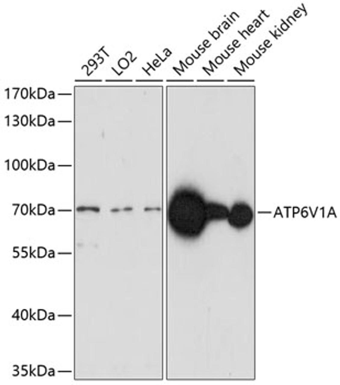 Western blot analysis of extracts of various cell lines using ATP6V1A Polyclonal Antibody at dilution of 1:1000.