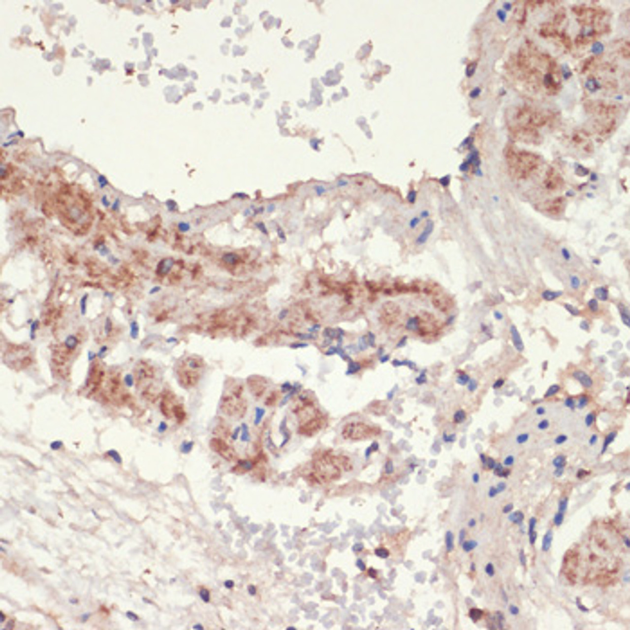 Immunohistochemistry of paraffin-embedded Rat lung using ADRA1A Polyclonal Antibody at dilution of  1:100 (40x lens).