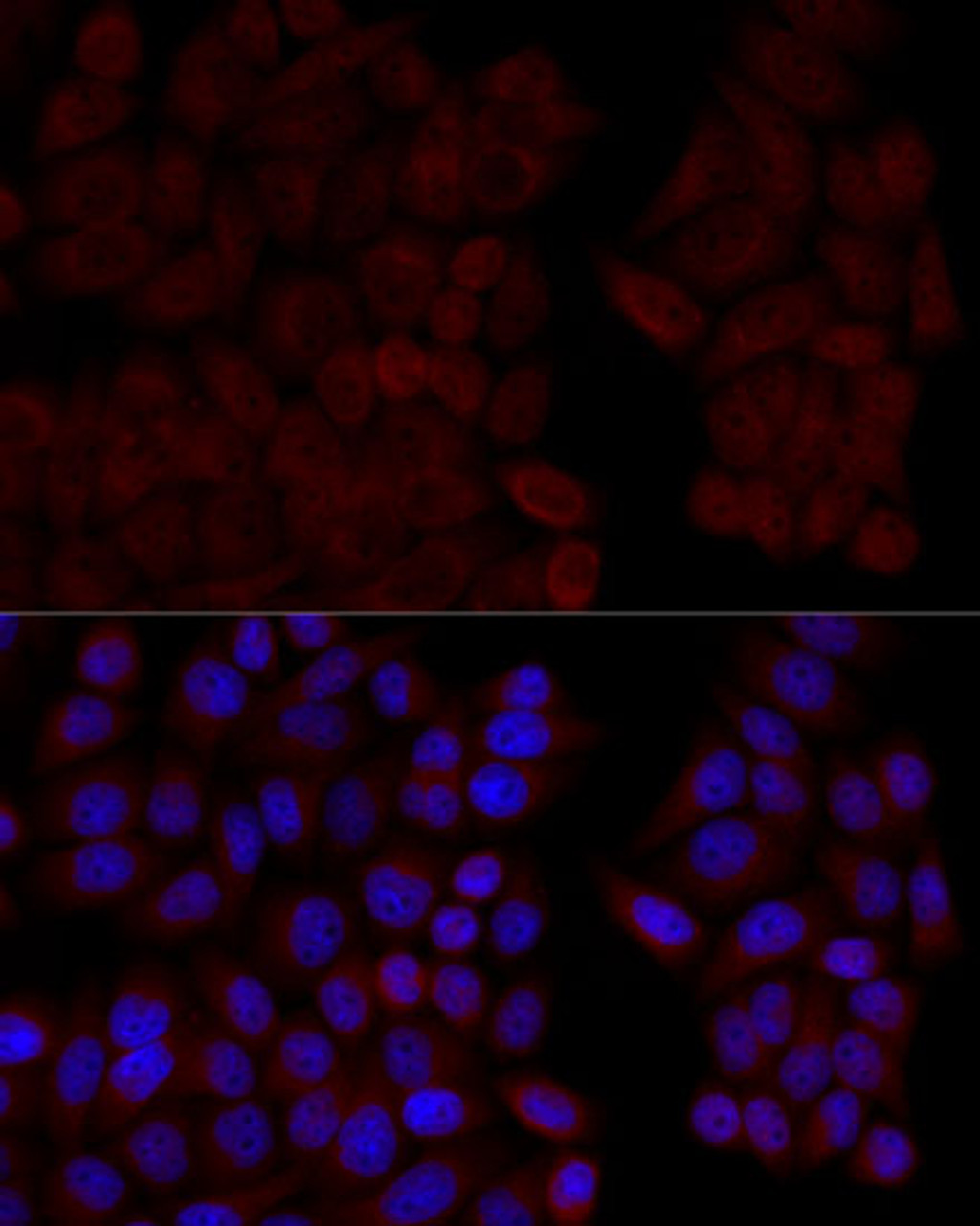 Immunofluorescence analysis of HeLa cells using CALM1 Polyclonal Antibody at dilution of  1:100 (40x lens). Blue: DAPI for nuclear staining.