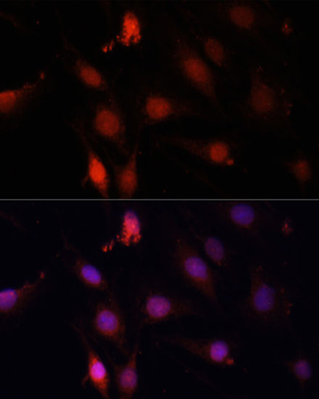 Immunofluorescence analysis of C6 cells using GBX2 Polyclonal Antibody at dilution of  1:100. Blue: DAPI for nuclear staining.