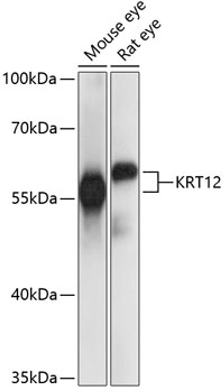 Western blot analysis of extracts of various cell lines using KRT12 Polyclonal Antibody at dilution of 1:1000.
