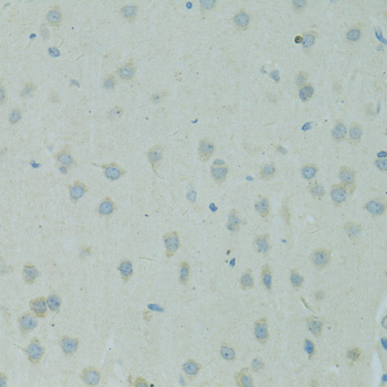 Immunohistochemistry of paraffin-embedded Rat brain using SMAD6 Polyclonal Antibody at dilution of  1:100 (40x lens).
