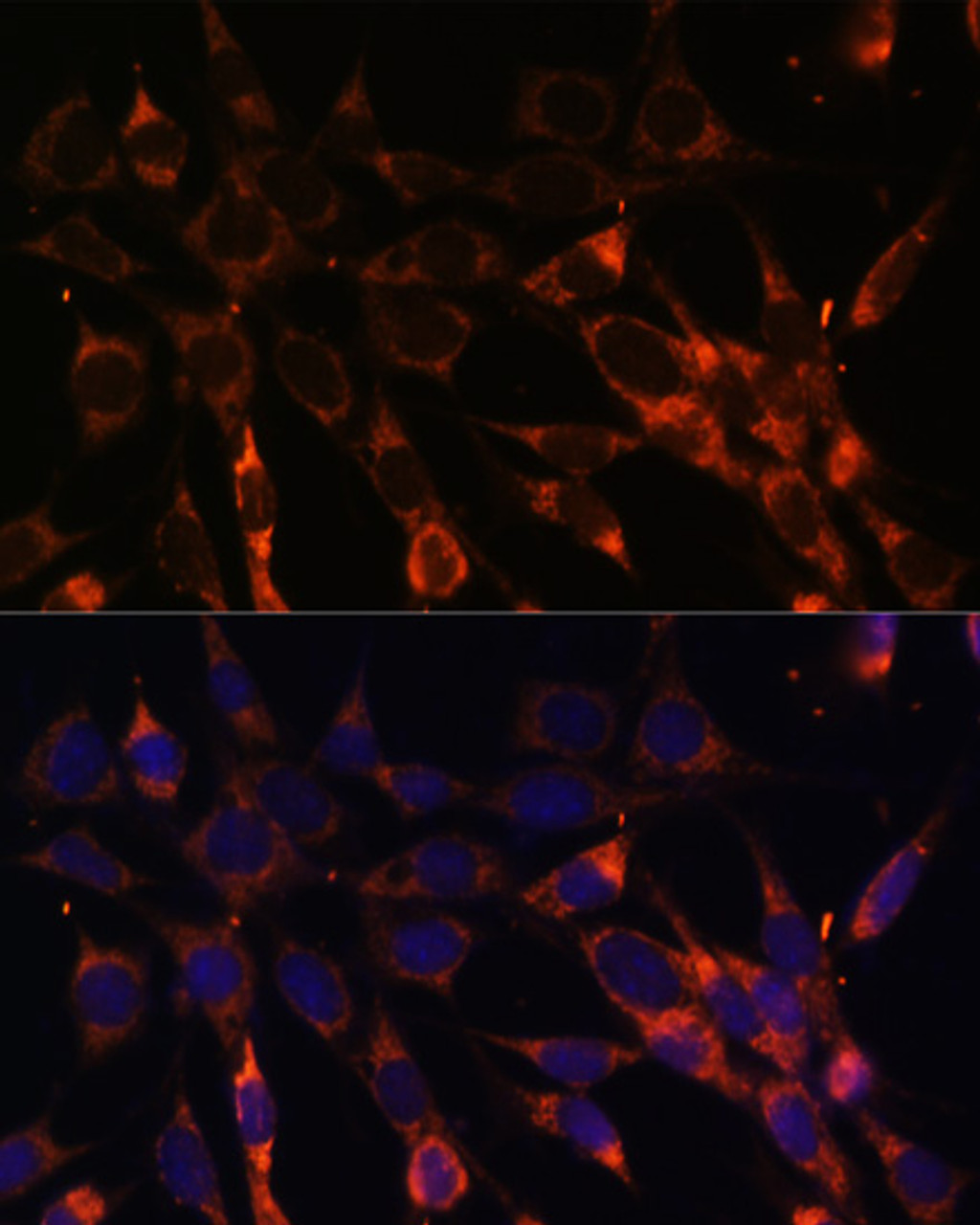 Immunofluorescence analysis of NIH-3T3 cells using SMAD6 Polyclonal Antibody at dilution of  1:100. Blue: DAPI for nuclear staining.