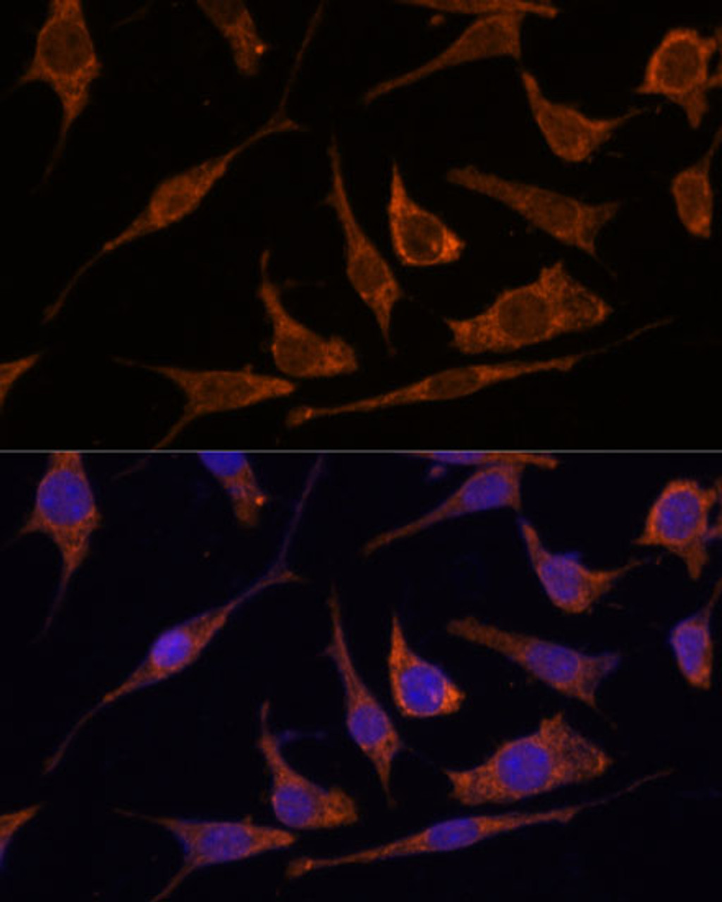 Immunofluorescence analysis of L929 cells using RPE Polyclonal Antibody at dilution of  1:100 (40x lens). Blue: DAPI for nuclear staining.