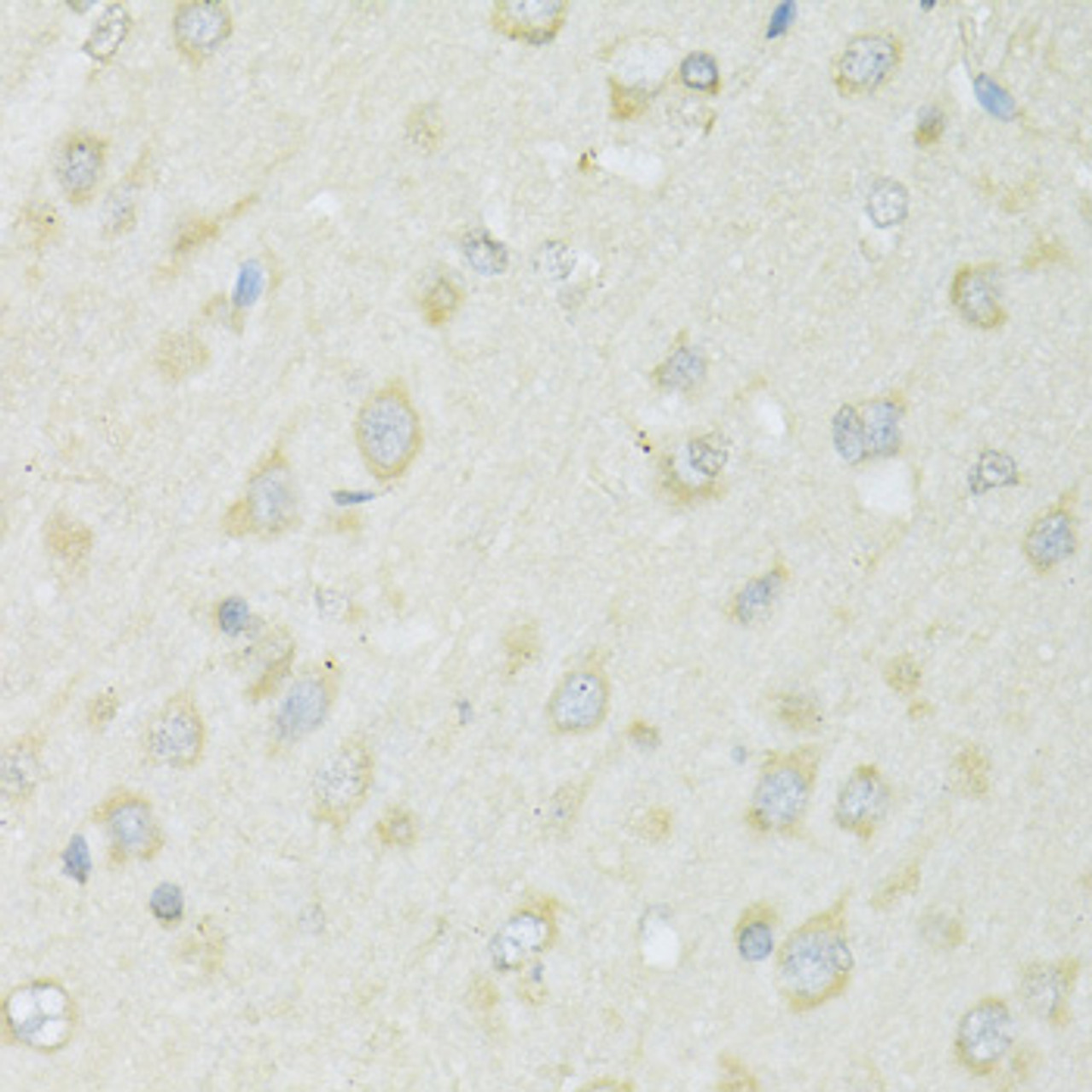 Immunohistochemistry of paraffin-embedded Rat brain using SLC22A5 Polyclonal Antibody at dilution of  1:100 (40x lens).