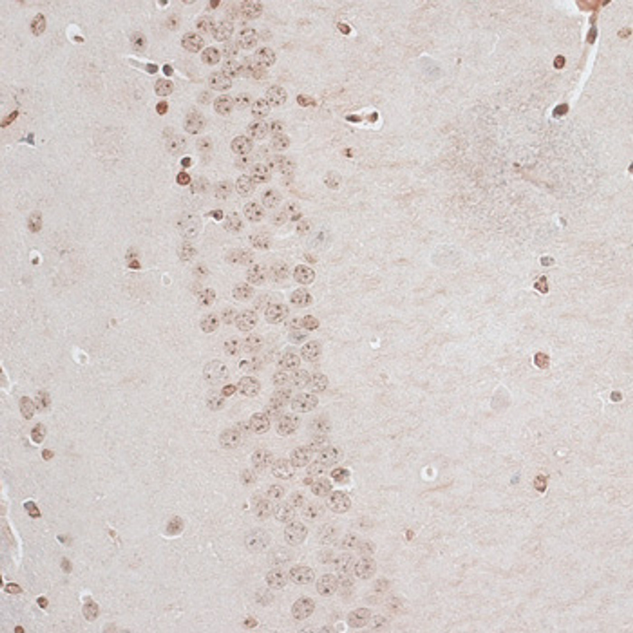 Immunohistochemistry of paraffin-embedded Mouse brain using ZNF177 Polyclonal Antibody at dilution of  1:100 (40x lens).