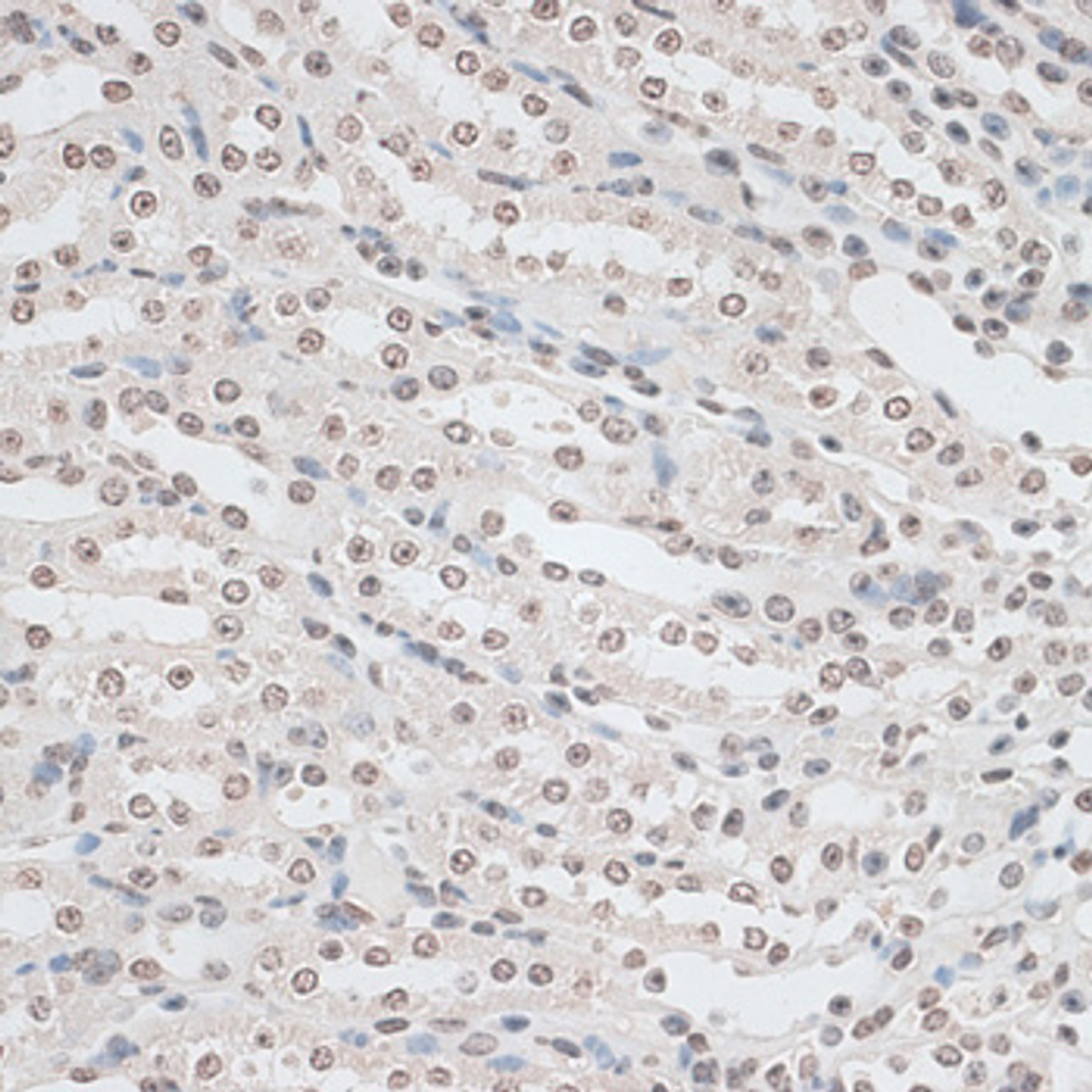 Immunohistochemistry of paraffin-embedded Mouse kidney using ZNF177 Polyclonal Antibody at dilution of  1:100 (40x lens).