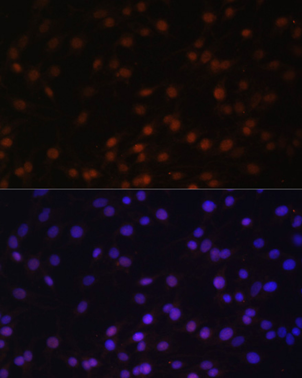 Immunofluorescence analysis of C6 cells using ZNF177 Polyclonal Antibody at dilution of  1:100. Blue: DAPI for nuclear staining.