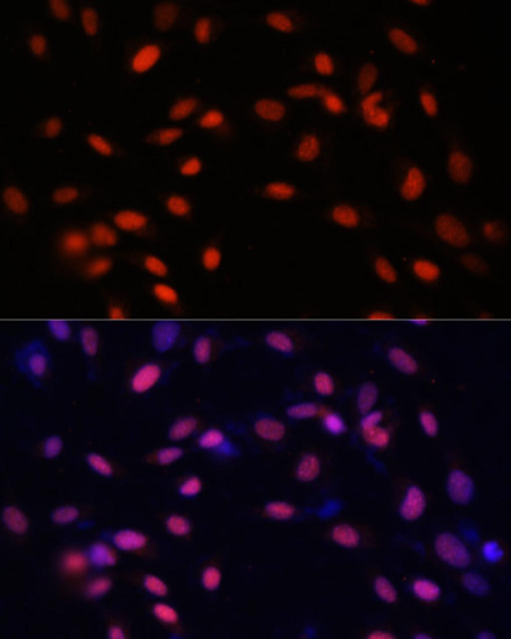 Immunofluorescence analysis of NIH-3T3 cells using ZNF177 Polyclonal Antibody at dilution of  1:100. Blue: DAPI for nuclear staining.