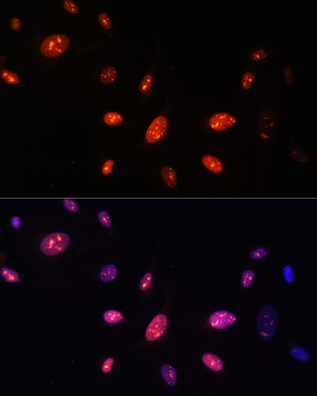 Immunofluorescence analysis of U-2 OS cells using ZNF177 Polyclonal Antibody at dilution of  1:100. Blue: DAPI for nuclear staining.