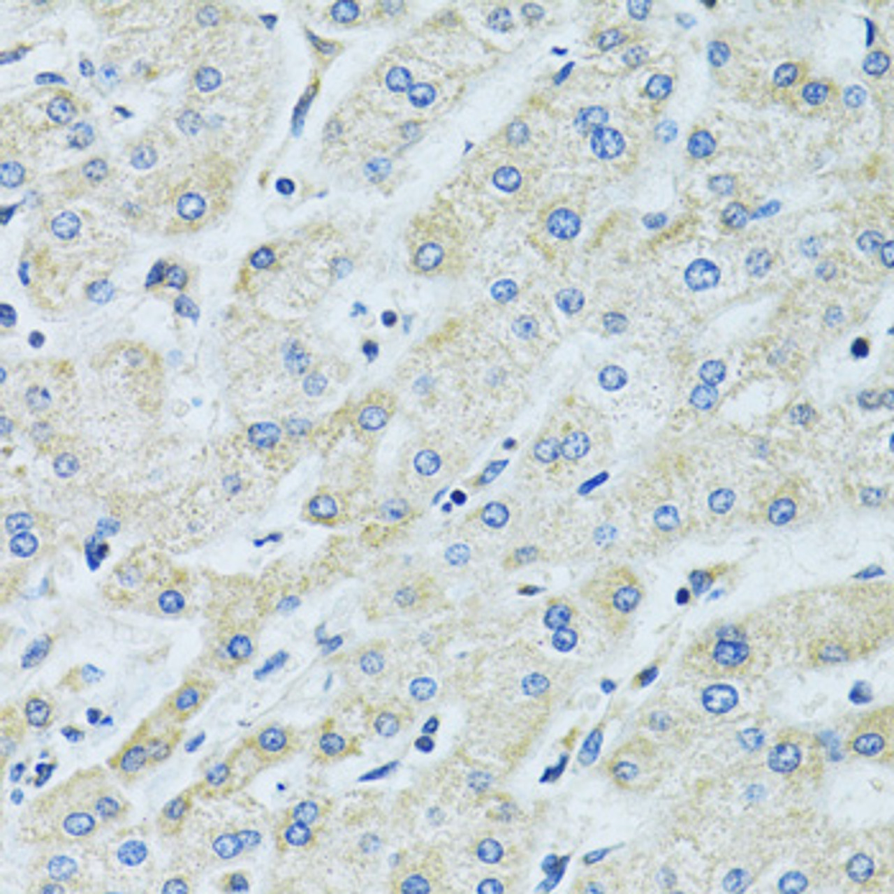 Immunohistochemistry of paraffin-embedded Human liver using SLC5A6 Polyclonal Antibody at dilution of  1:100 (40x lens).