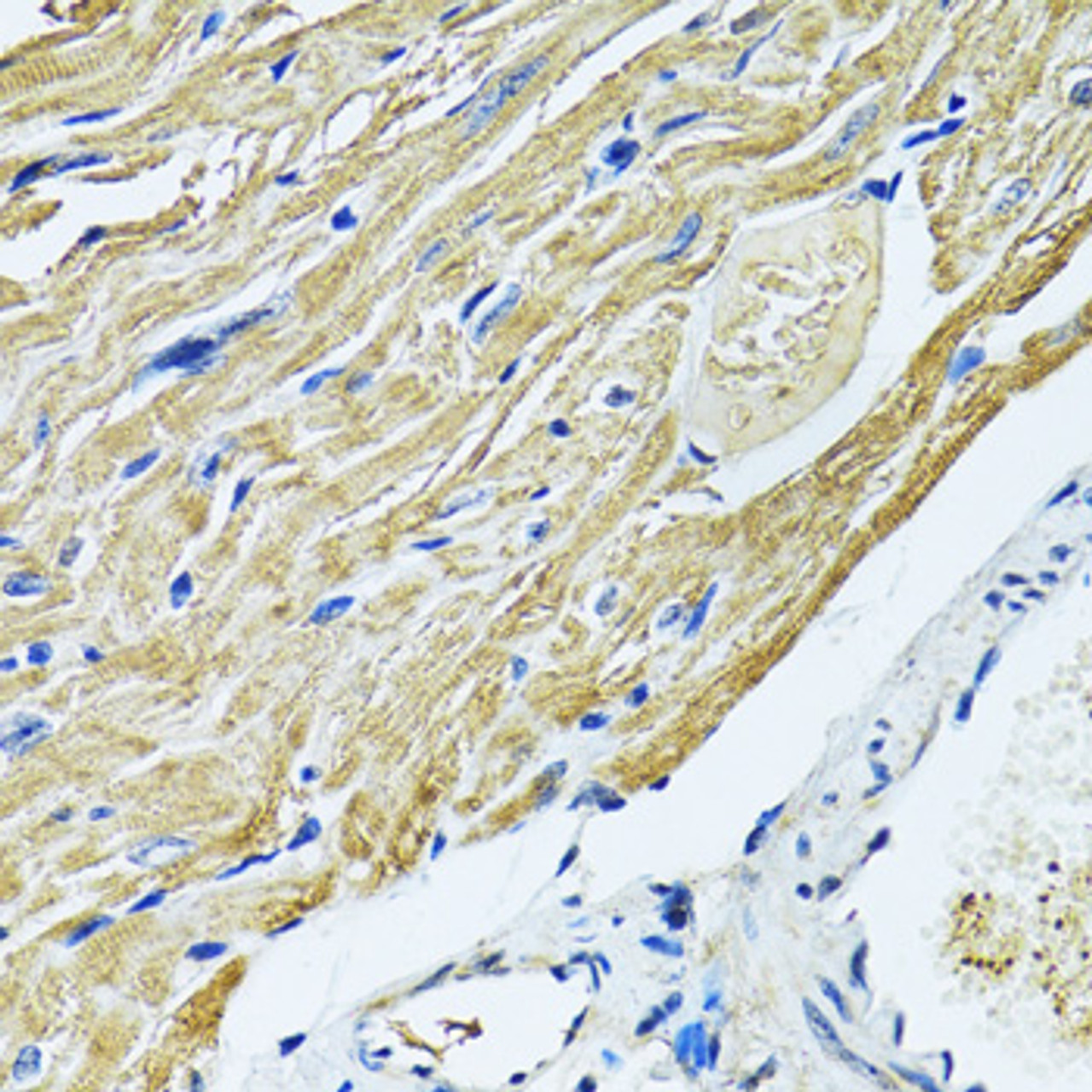 Immunohistochemistry of paraffin-embedded Mouse heart using SLC5A6 Polyclonal Antibody at dilution of  1:100 (40x lens).