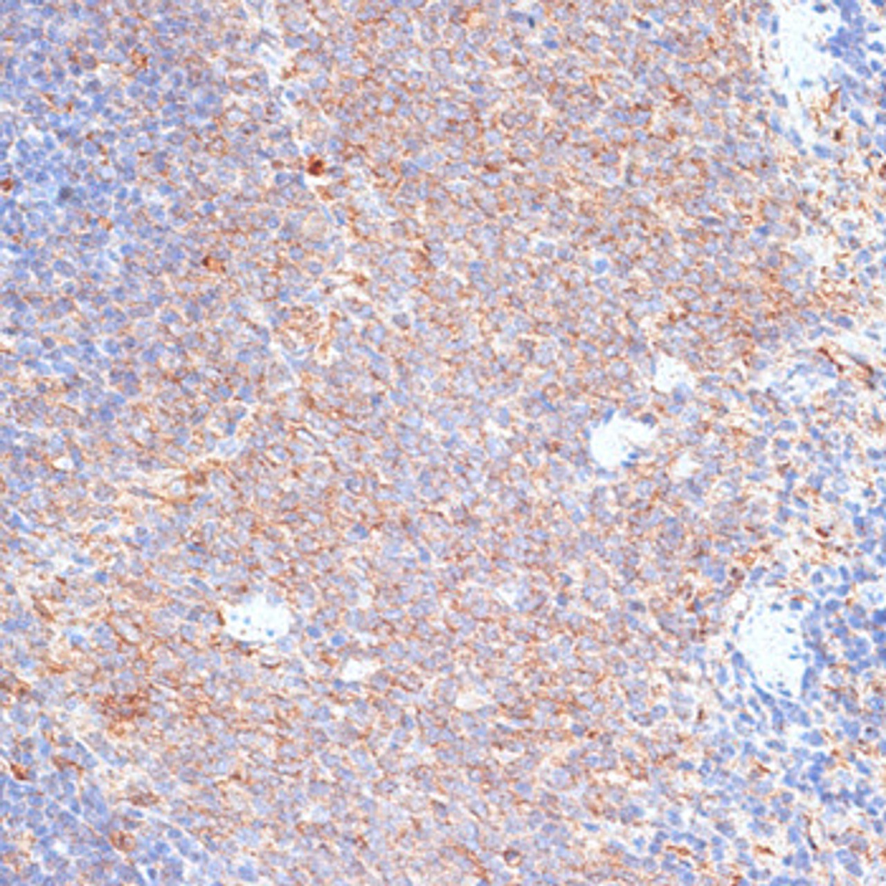 Immunohistochemistry of paraffin-embedded Rat spleen using G3BP1 Polyclonal Antibody at dilution of  1:100 (40x lens).