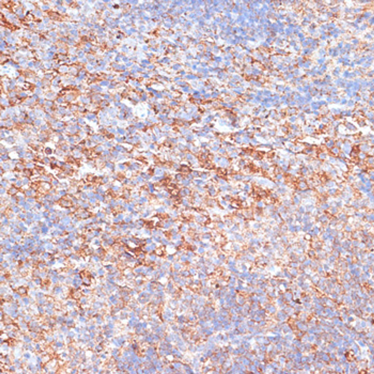 Immunohistochemistry of paraffin-embedded Mouse spleen using G3BP1 Polyclonal Antibody at dilution of  1:100 (40x lens).