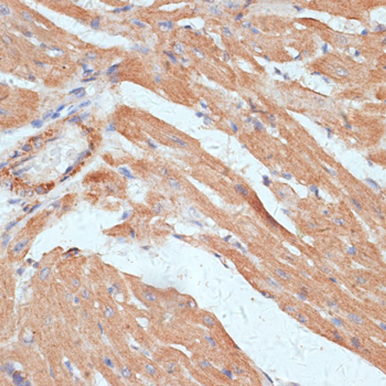 Immunohistochemistry of paraffin-embedded Mouse heart using G3BP1 Polyclonal Antibody at dilution of  1:100 (40x lens).
