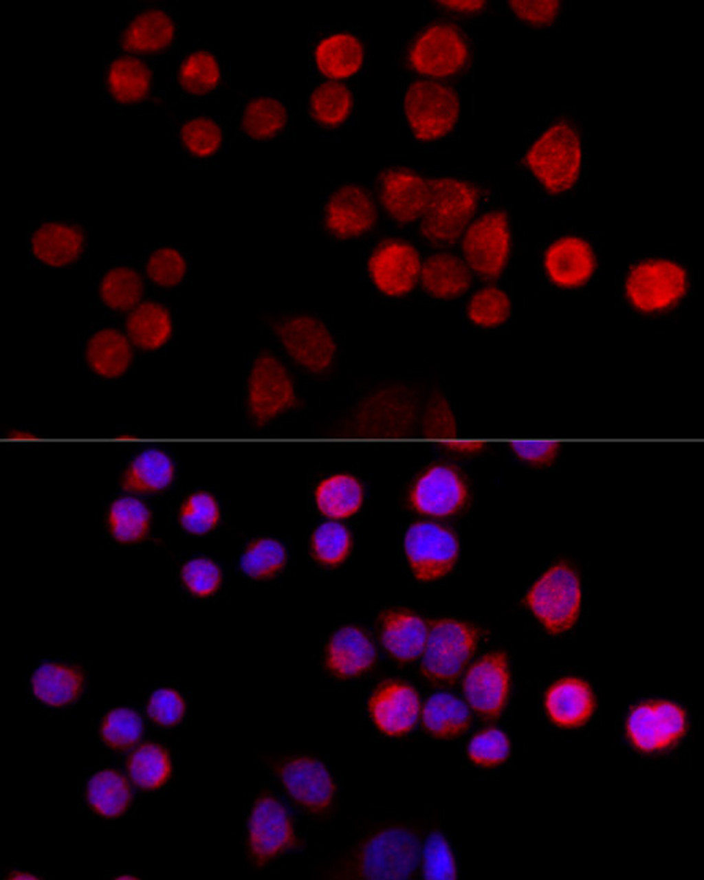 Immunofluorescence analysis of 293T cells using SLC25A17 Polyclonal Antibody at dilution of  1:100 (40x lens). Blue: DAPI for nuclear staining.