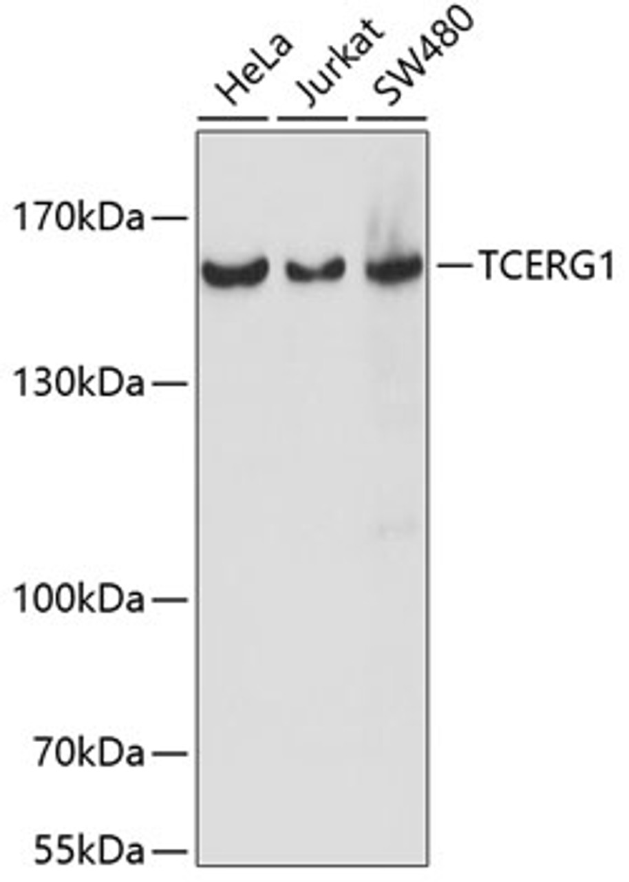 Western blot analysis of extracts of various cell lines using TCERG1 Polyclonal Antibody at dilution of 1:1000.